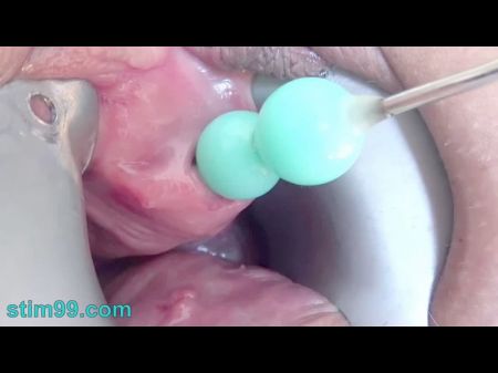 indian urethra insertion